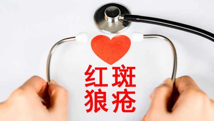 規(guī)范診療之下,，紅斑狼瘡病情可控